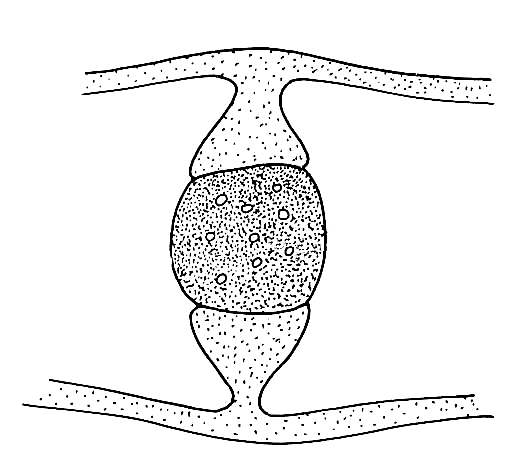 Rhizopus Reproduction 3 - structure becomes a zygospore
