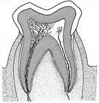 Molar